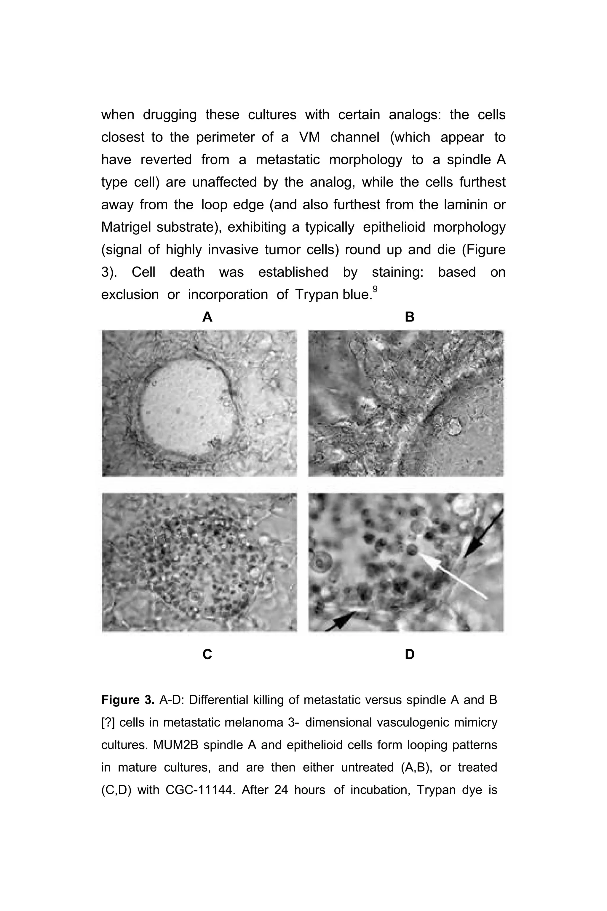 when drugging these cultures with certain analogs: the cells
closest to the perimeter of a VM channel (which appear to
have reverted from a metastatic morphology to a spindle A
type cell) are unaffected by the analog, while the cells furthest
away from the loop edge (and also furthest from the laminin or
Matrigel substrate), exhibiting a typically epithelioid morphology
(signal of highly invasive tumor cells) round up and die (Figure
3). Cell death was established by staining: based on
exclusion or incorporation of Trypan blue.9
A B
C D
Figure 3. A-D: Differential killing of metastatic versus spindle A and B
[?] cells in metastatic melanoma 3- dimensional vasculogenic mimicry
cultures. MUM2B spindle A and epithelioid cells form looping patterns
in mature cultures, and are then either untreated (A,B), or treated
(C,D) with CGC-11144. After 24 hours of incubation, Trypan dye is
 