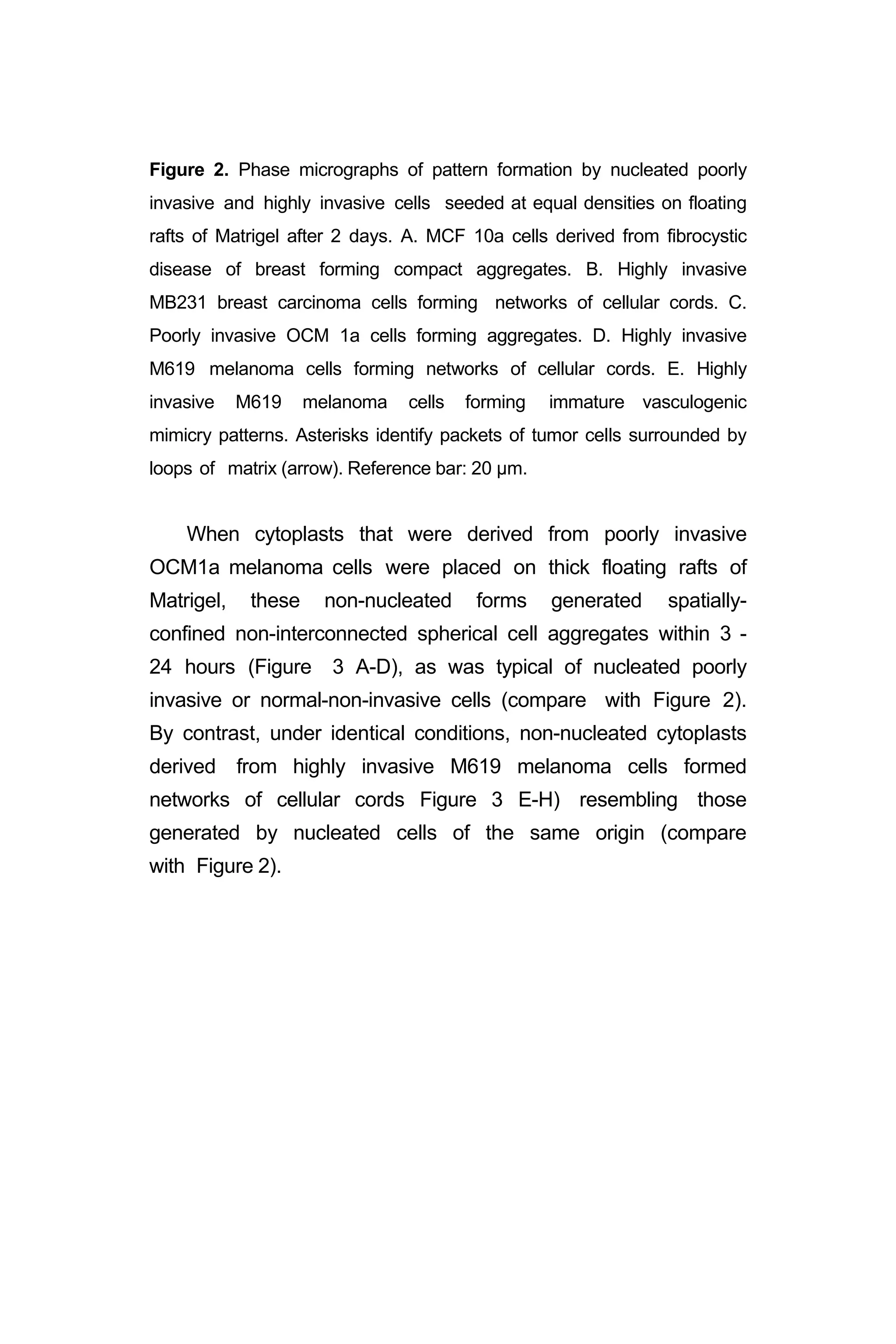 Figure 2. Phase micrographs of pattern formation by nucleated poorly
invasive and highly invasive cells seeded at equal densities on floating
rafts of Matrigel after 2 days. A. MCF 10a cells derived from fibrocystic
disease of breast forming compact aggregates. B. Highly invasive
MB231 breast carcinoma cells forming networks of cellular cords. C.
Poorly invasive OCM 1a cells forming aggregates. D. Highly invasive
M619 melanoma cells forming networks of cellular cords. E. Highly
invasive M619 melanoma cells forming immature vasculogenic
mimicry patterns. Asterisks identify packets of tumor cells surrounded by
loops of matrix (arrow). Reference bar: 20 µm.
When cytoplasts that were derived from poorly invasive
OCM1a melanoma cells were placed on thick floating rafts of
Matrigel, these non-nucleated forms generated spatially-
confined non-interconnected spherical cell aggregates within 3 -
24 hours (Figure 3 A-D), as was typical of nucleated poorly
invasive or normal-non-invasive cells (compare with Figure 2).
By contrast, under identical conditions, non-nucleated cytoplasts
derived from highly invasive M619 melanoma cells formed
networks of cellular cords Figure 3 E-H) resembling those
generated by nucleated cells of the same origin (compare
with Figure 2).
 