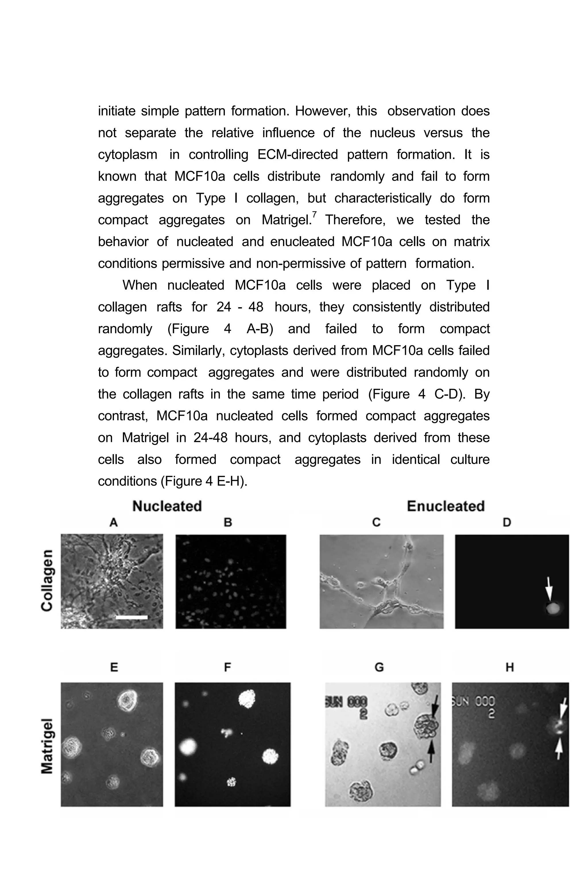 initiate simple pattern formation. However, this observation does
not separate the relative influence of the nucleus versus the
cytoplasm in controlling ECM-directed pattern formation. It is
known that MCF10a cells distribute randomly and fail to form
aggregates on Type I collagen, but characteristically do form
compact aggregates on Matrigel.7
Therefore, we tested the
behavior of nucleated and enucleated MCF10a cells on matrix
conditions permissive and non-permissive of pattern formation.
When nucleated MCF10a cells were placed on Type I
collagen rafts for 24 - 48 hours, they consistently distributed
randomly (Figure 4 A-B) and failed to form compact
aggregates. Similarly, cytoplasts derived from MCF10a cells failed
to form compact aggregates and were distributed randomly on
the collagen rafts in the same time period (Figure 4 C-D). By
contrast, MCF10a nucleated cells formed compact aggregates
on Matrigel in 24-48 hours, and cytoplasts derived from these
cells also formed compact aggregates in identical culture
conditions (Figure 4 E-H).
 