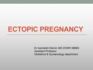 ECTOPIC PREGNANCY
Dr Isameldin Elamin MD DOWH MBBS
Assistant Professor
Obstetrics & Gynaecology department
 