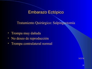 30
Embarazo EctópicoEmbarazo Ectópico
Tratamiento Quirúrgico: Salpingectomía
• Trompa muy dañada
• No deseo de reproducción
• Trompa contralateral normal
NEFM
 