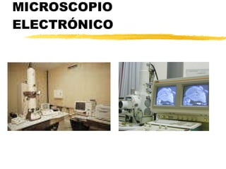 MICROSCOPIO ELECTRÓNICO 