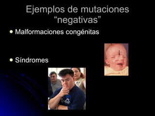 Ejemplos de mutaciones “negativas” Malformaciones congénitas Síndromes 
