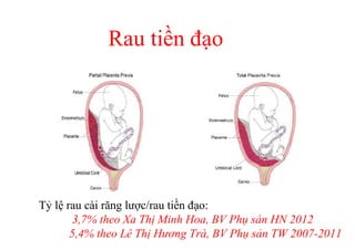Rau tiền đạo 
Tỷ lệ rau cài răng lược/rau tiền đạo: 
3,7% theo Xa Thị Minh Hoa, BV Phụ sản HN 2012 
5,4% theo Lê Thị Hương Trà, BV Phụ sản TW 2007-2011 
 