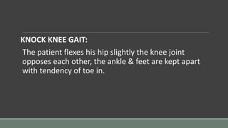 KNOCK KNEE GAIT:
The patient flexes his hip slightly the knee joint
opposes each other, the ankle & feet are kept apart
with tendency of toe in.
 