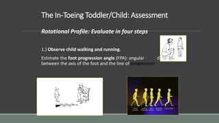The In-Toeing Toddler/Child: Assessment
Rotational Profile: Evaluate in four steps
1.) Observe child walking and running.
Estimate the foot progression angle (FPA): angular difference
between the axis of the foot and the line of progression
 