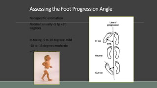 Assessing the Foot Progression Angle
Nonspecific estimation
Normal: usually -5 tp +20
degrees
In-toeing -5 to-10 degrees: mild
-10 to -15 degrees moderate
>-15 degrees severe
 