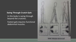 Swing Through Crutch Gait:
In this body is swing through
beyond the crutches.
Fastest gait,requires functional
abdominal muscles.
 