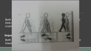 Both crutuhes support weaker lower limb, while the stronger
limb takes whole body weight without any support from the
crutches.
Sequence of events:
Both crutches & the weaker lower limb together, the stronger
lower limb.
 