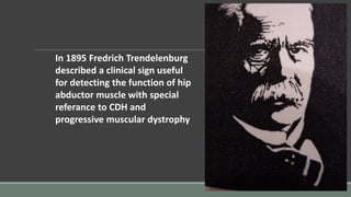 In 1895 Fredrich Trendelenburg
described a clinical sign useful
for detecting the function of hip
abductor muscle with special
referance to CDH and
progressive muscular dystrophy
 