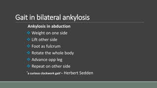Gait in bilateral ankylosis
Ankylosis in abduction
 Weight on one side
 Lift other side
 Foot as fulcrum
 Rotate the whole body
 Advance opp leg
 Repeat on other side
‘a curious clockwork gait’– Herbert Sedden
 