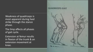 Weakness of quadriceps is
most apparent during heel
strike through the stance
phase.
The limp affects all phases
of gait cycle.
Extension at femur results
in flexion of the trunk & an
extension movement at
knee.
 