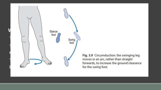WEAKNESS OF HIP FLEXORS:
The patient will have difficulty in initiating swing through.
To compensate for this specific muscular weakness patient
externally rotates leg & uses hip adductors for swing through.
This circumduction of hip exaggerates energy expenditure &
produces extreme trunk & pelvis motion.
 