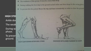 HIGH STEPPING GAIT:
Ankle dorsiflexors act during the swing phase of cycle.
The weakness of this group of muscles causes foot drop.
During walking foot slap in ground on heel strike & then drops in swing
phase.
To prevent this patient flexes hip & knee excessively in order to clear the
ground.
 
