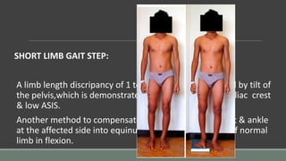 SHORT LIMB GAIT STEP:
A limb length discripancy of 1 to 1.5 inch is compensated by tilt of
the pelvis,which is demonstrated by a low shoulder,low iliac crest
& low ASIS.
Another method to compensate shortening is to put foot & ankle
at the affected side into equinus position & hip & knee of normal
limb in flexion.
 