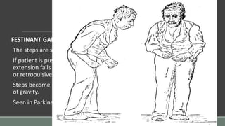 FESTINANT GAIT:
The steps are short so that feet barely clear floor.
If patient is pushed backward or forward, compensatory flexion or
extension fails to occur & patients is forced to make a series of propulsive
or retropulsive steps with forward locomotion.
Steps become successively more rapid as if trying to catch up with centre
of gravity.
Seen in Parkinson's disease.
 