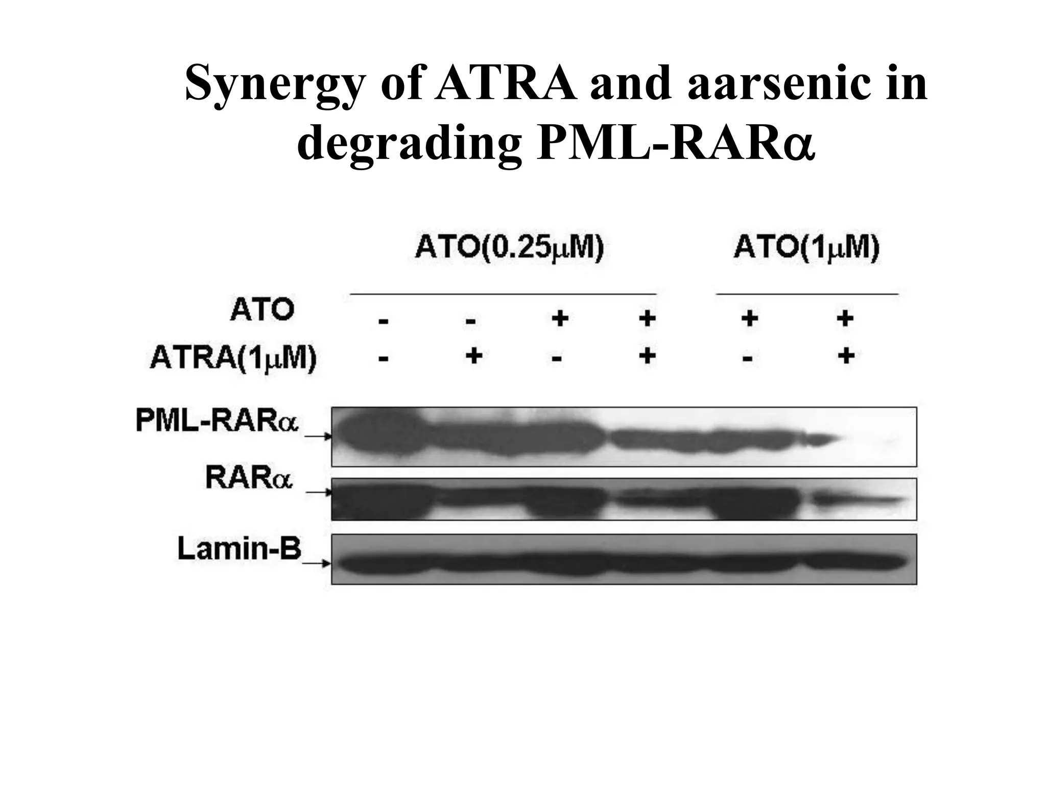Synergy of ATRA and aarsenic in 
degrading PML-RAR 
 