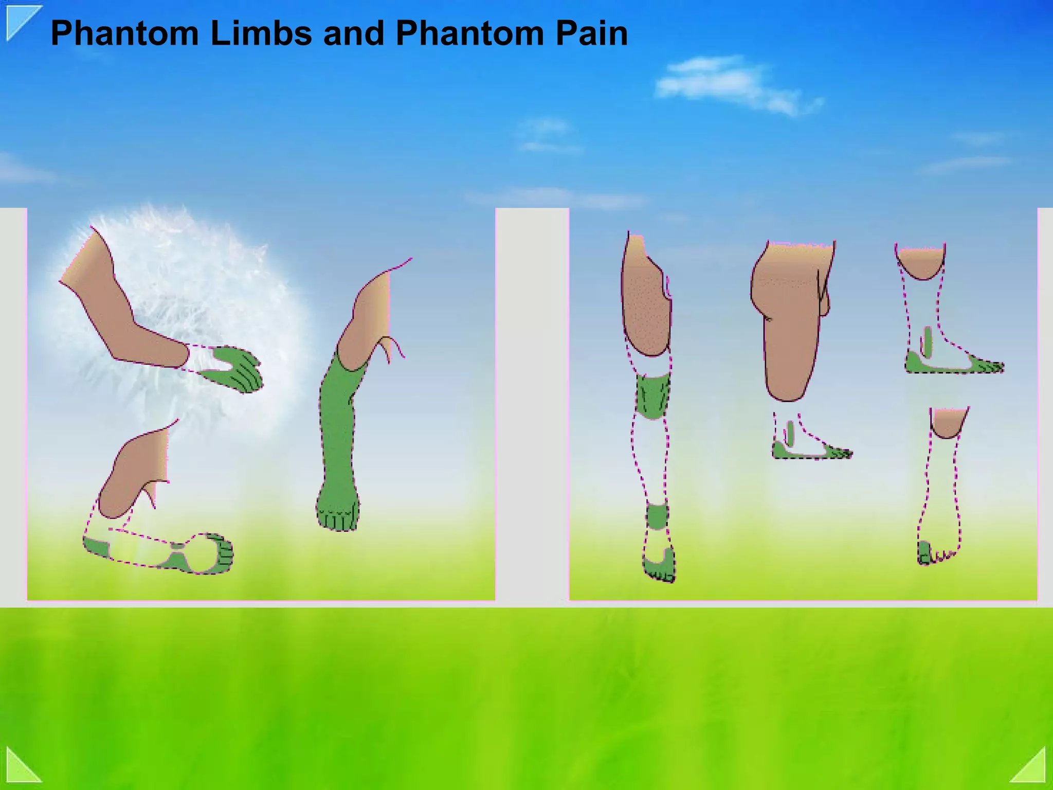 Phantom Limbs and Phantom Pain 