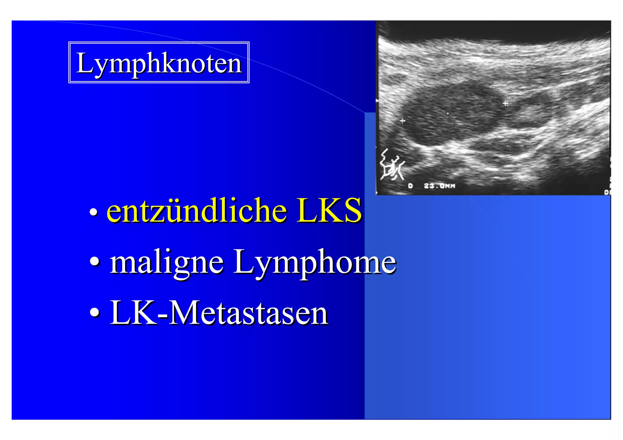 Lymphknoten Sonographie In Der Nähe www.slideshare.net