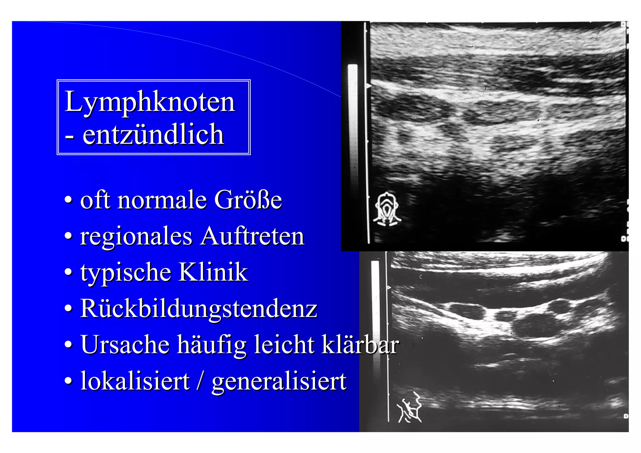 06 Sonographie Der Milz Lymphknotenver nderungen Im Abdomen 06-sonographie-der-milz-lymphknotenver-nderungen-im-abdomen