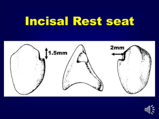 b- Types of tooth rests | PPT
