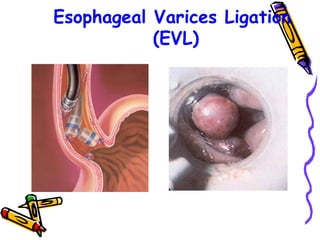 TAEM10:Roles of endoscopic nurse | PPS