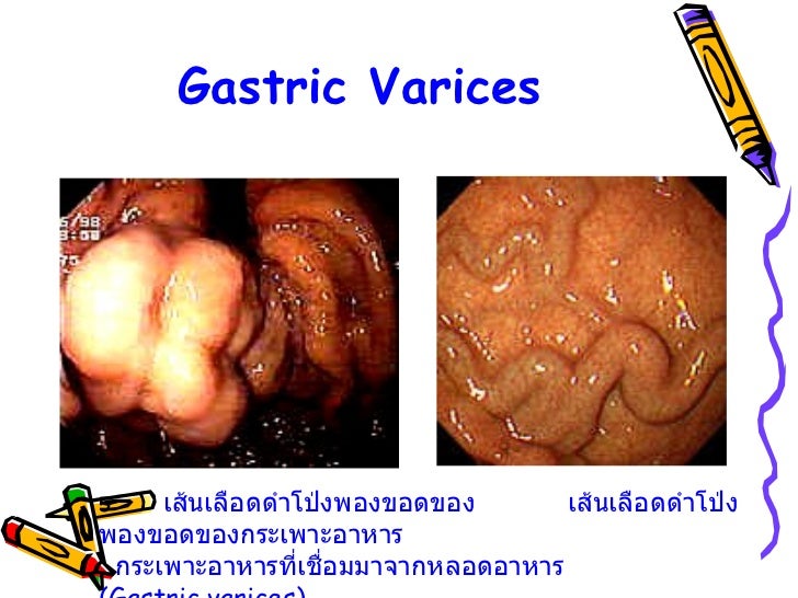 TAEM10Roles of endoscopic nurse