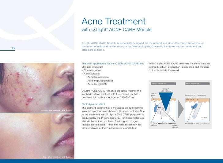 Q.Light Phototherapy for Skin Care applications