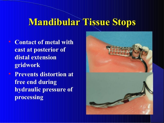 07 1 minor connectors hamular notch