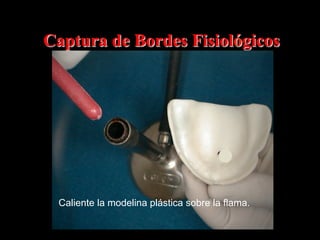 Captura de Bordes Fisiológicos

Caliente la modelina plástica sobre la flama.

 