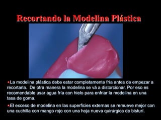 Recortando la Modelina Plástica

" La modelina plástica debe estar completamente fría antes de empezar a
recortarla. De otra manera la modelina se vá a distorcionar. Por eso es
recomendable usar agua fría con hielo para enfriar la modelina en una
tasa de goma.
" El exceso de modelina en las superficies externas se remueve mejor con
una cuchilla con mango rojo con una hoja nueva quirúrgica de bisturí.

 