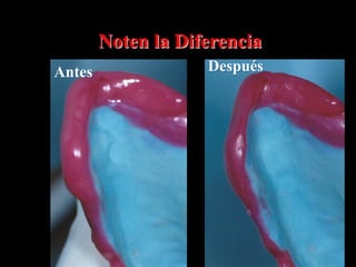 Noten la Diferencia
Antes

Después

 