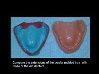 Compare the extensions of the border molded tray with
those of the old denture.

 
