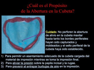 ¿Cuál es el Propósito
de la Abertura en la Cubeta?

Cuidado: No perforen la abertura
de alivio en la cubeta maxilar
hasta tanto los bordes periferales
hayan sido capturados y
moldeados y el sello periferal de la
cubeta haya sido establecido.
1) Para permitir un asentamiento adecuado de la cubeta cargada del

material de impresión mientras se toma la impresión final.
2)  Para aliviar la presión sobre la papila incisal y la rugae.
3)  Para prevenir el entrapar burbujas de aire en la impresión.

 