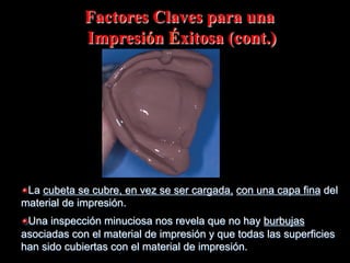 Factores Claves para una
Impresión Éxitosa (cont.)

" La cubeta se cubre, en vez se ser cargada, con una capa fina del
material de impresión.
" Una inspección minuciosa nos revela que no hay burbujas
asociadas con el material de impresión y que todas las superficies
han sido cubiertas con el material de impresión.

 