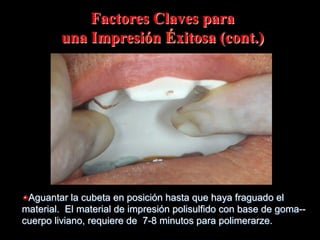 Factores Claves para
una Impresión Éxitosa (cont.)

"  Aguantar la cubeta en posición hasta que haya fraguado el
material. El material de impresión polisulfido con base de goma-cuerpo liviano, requiere de 7-8 minutos para polimerarze.

 