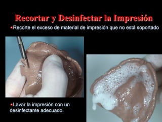 Recortar y Desinfectar la Impresión
"  Recorte el exceso de material de impresión que no está soportado

"  Lavar la impresión con un
desinfectante adecuado.

 