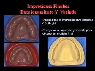 Impresiones Finales:
Encajonamiento Y Vaciado
"  Inspeccione la impresión para defectos
o burbujas
"  Encajonar la impresión y vaciarla para
obtener un modelo final

 