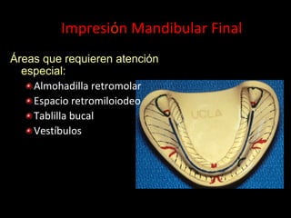 Impresiόn	
  Mandibular	
  Final	
  
Áreas que requieren atenciόn
especial:
" Almohadilla	
  retromolar	
  
" Espacio	
  retromiloiodeo	
  
" Tablilla	
  bucal	
  
" Vestíbulos	
  

 