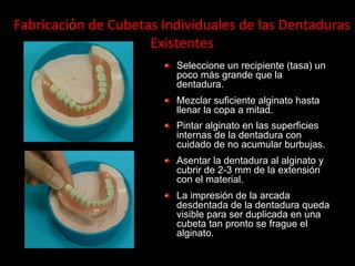 Fabricaciόn	
  de	
  Cubetas	
  Individuales	
  de	
  las	
  Dentaduras	
  
Existentes	
  
"

Seleccione un recipiente (tasa) un
poco más grande que la
dentadura.

"

Mezclar suficiente alginato hasta
llenar la copa a mitad.

"

Pintar alginato en las superficies
internas de la dentadura con
cuidado de no acumular burbujas.

"

Asentar la dentadura al alginato y
cubrir de 2-3 mm de la extensiόn
con el material.

"

La impresiόn de la arcada
desdentada de la dentadura queda
visible para ser duplicada en una
cubeta tan pronto se frague el
alginato.

 