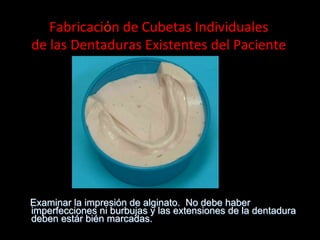 Fabricaciόn	
  de	
  Cubetas	
  Individuales	
  	
  	
  
de	
  las	
  Dentaduras	
  Existentes	
  del	
  Paciente	
  	
  

Examinar la impresiόn de alginato. No debe haber
imperfecciones ni burbujas y las extensiones de la dentadura
deben estár bién marcadas.

 