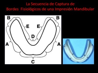 La	
  Secuencia	
  de	
  Captura	
  de	
  	
  
Bordes	
  	
  Fisiolόgicos	
  de	
  una	
  Impresiόn	
  Mandibular	
  

 