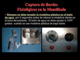 Captura de Bordes
Fisiolόgicos en la Mandíbula
"   Siempre se debe templar la modelina plástica en el baño

de agua por 5 segundos antes de colocar la modelina cliente en
la boca del paciente. El baño de agua se debe ajustar a 110ºF
grados cuando se use modelina plástica de baja fusiόn.

 