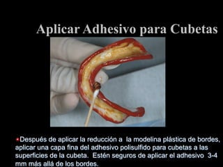Aplicar Adhesivo para Cubetas

"  Después de aplicar la reducciόn a la modelina plástica de bordes,
aplicar una capa fina del adhesivo polisulfido para cubetas a las
superficies de la cubeta. Estén seguros de aplicar el adhesivo 3-4
mm más allá de los bordes.

 
