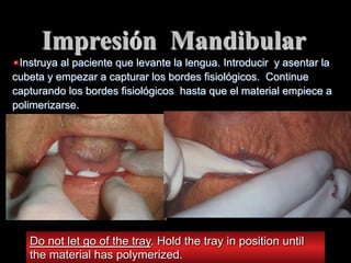 Impresión Mandibular
"  Instruya al paciente que levante la lengua. Introducir y asentar la
cubeta y empezar a capturar los bordes fisiolόgicos. Continue
capturando los bordes fisiológicos hasta que el material empiece a
polimerizarse.

Do not let go of the tray. Hold the tray in position until
the material has polymerized.

 