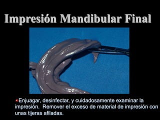 Impresiόn Mandibular Final

"  Enjuagar, desinfectar, y cuidadosamente examinar la
impresión. Remover el exceso de material de impresiόn con
unas tijeras afiladas.

 