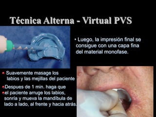 Técnica Alterna - Virtual PVS
• Luego, la impresión final se
consigue con una capa fina
del material monofase.

"   Suavemente masage los
labios y las mejillas del paciente
"  Despues de 1 min. haga que
"  el paciente arruge los labios,
sonría y mueva la mandíbula de
lado a lado, al frente y hacia atrás.

 
