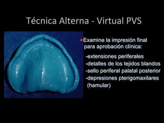  Técnica	
  Alterna	
  -­‐	
  Virtual	
  PVS	
  
"  Examine la impresión final
para aprobaciόn clínica:
-extensiones periferales
-detalles de los tejidos blandos
-sello periferal palatal posterior
-depresiones pterigomaxilares
(hamular)

 