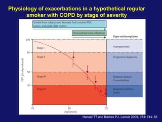 Hansel TT and Barnes PJ, Lancet 2009; 374: 744–55
Physiology of exacerbations in a hypothetical regular
smoker with COPD by stage of severity
 