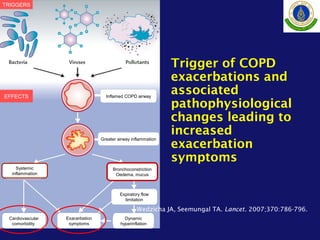 Cardiovascular
comorbidity
Exacerbation
symptoms
Dynamic
hyperinflation
Expiratory flow
limitation
Bronchoconstriction
Oedema, mucus
Systemic
inflammation
Greater airway inflammation
Inflamed COPD airway
TRIGGERS
EFFECTS
Trigger of COPD
exacerbations and
associated
pathophysiological
changes leading to
increased
exacerbation
symptoms
Wedzicha JA, Seemungal TA. Lancet. 2007;370:786-796.
 